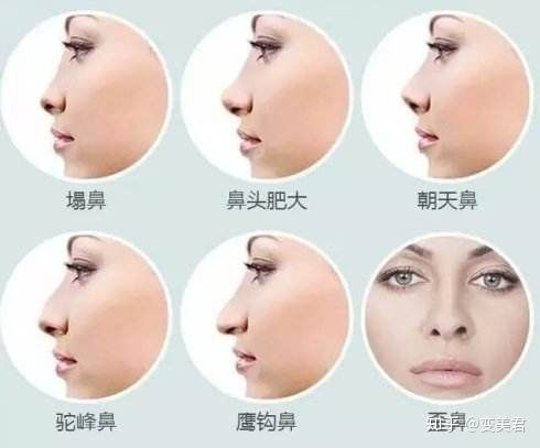 蹬鼻子上脸的深层含义与解读