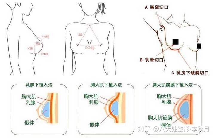挺乃儿丰胸产品，重塑女性魅力的秘密武器