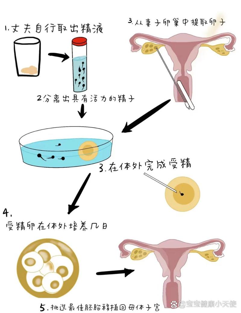 探究取卵过程中腹水产生的原因