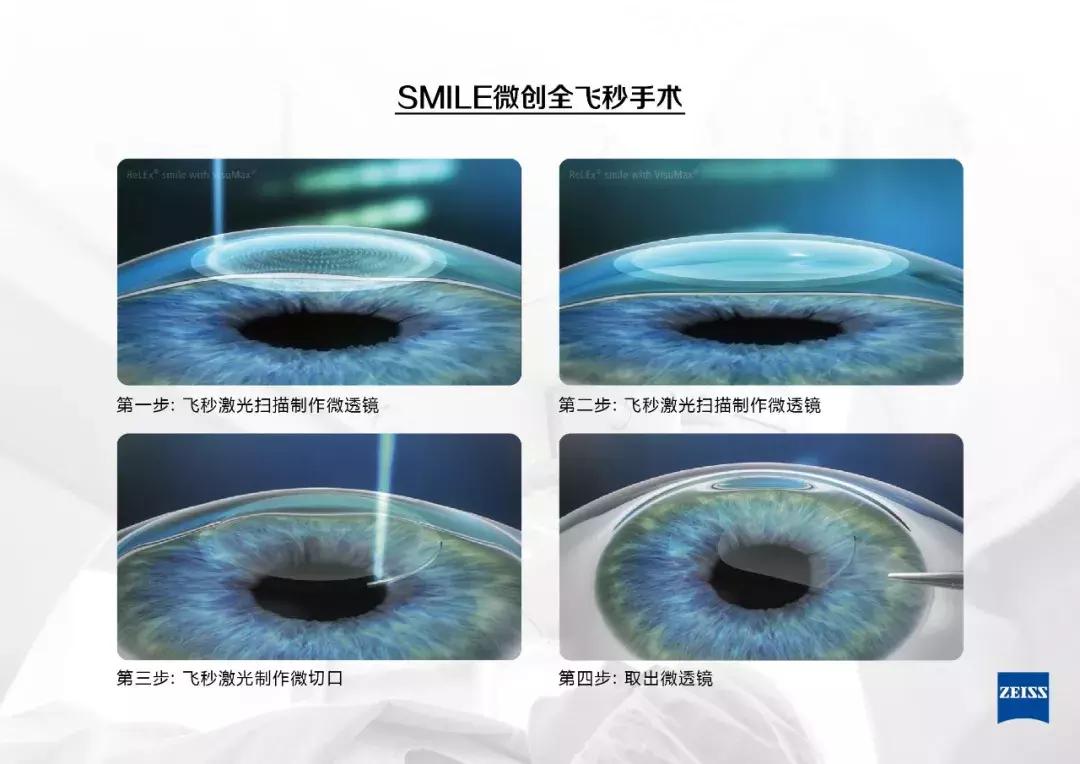 蔡司镜片如何验真假——深度解析鉴别方法与技巧