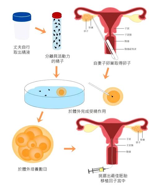 探究取卵少的原因及其影响因素