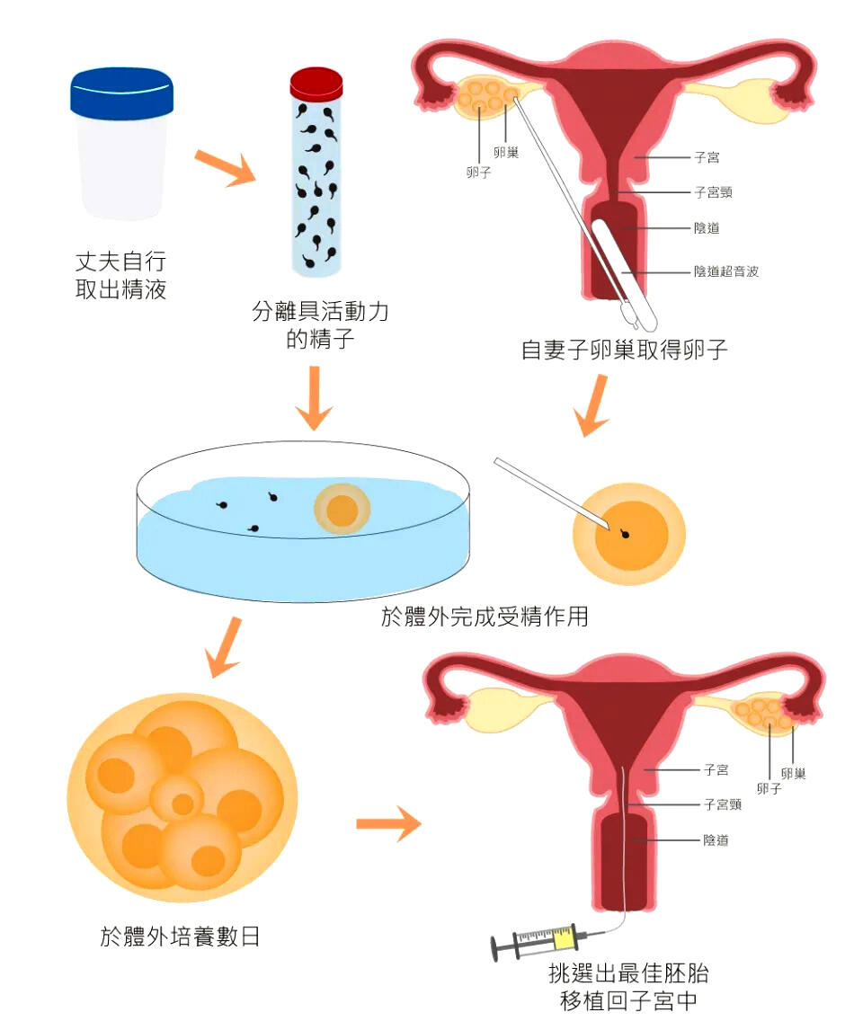 关于做试管婴儿过程中减少取卵数量的策略探讨