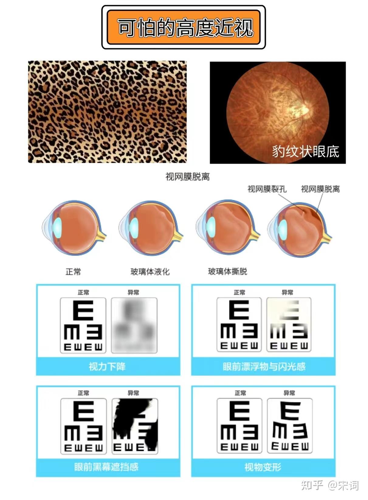 淘宝近视镜片真假的辨别与选购指南